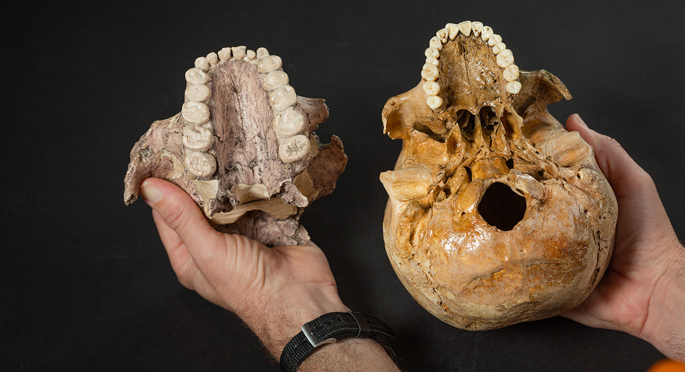 A comparison of the upper teeth of humankind’s near-cousin, Paranthropus boisei, which lived about two million years ago, with a modern human skull.